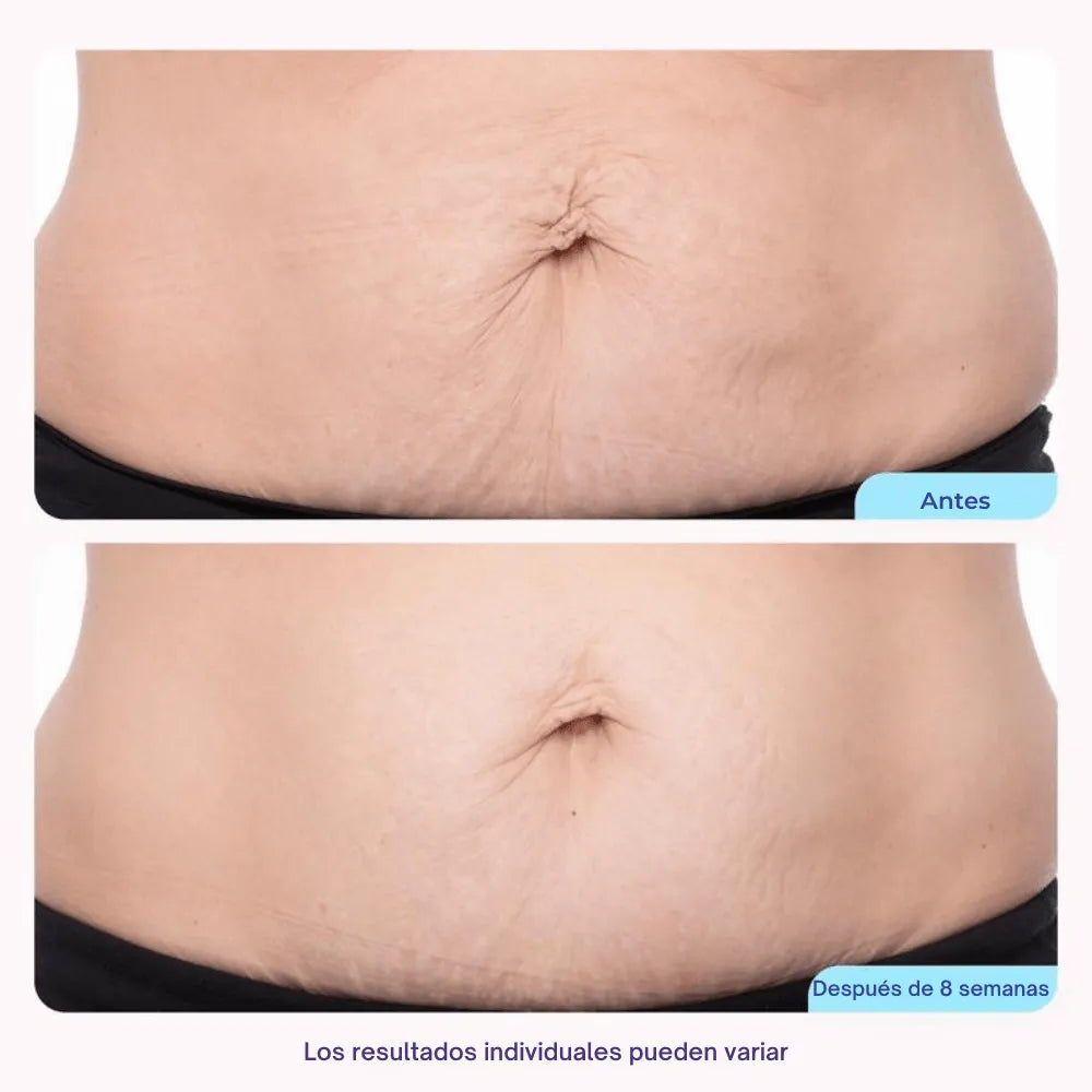 Crema Reafirmante de Abdomen  – Reduce Medidas y Tonifica la Piel del Vientre