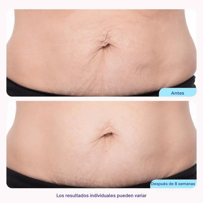 Crema Reafirmante de Abdomen  – Reduce Medidas y Tonifica la Piel del Vientre